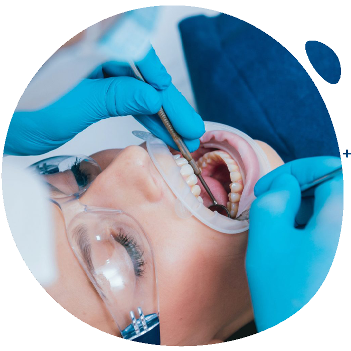 dental-chirurgy https://hervident.al/wp-content/uploads/2022/08/dental-chirurgy.png